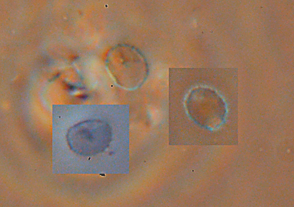Crosta su abete - foto 0157 (Heterobasidion annosum)